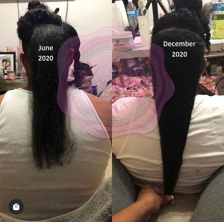 Onion Hair Growth Oil | Edges |Alopecia | Bald | Natural Hair | DHT blocker 4oz. (with essential oils)