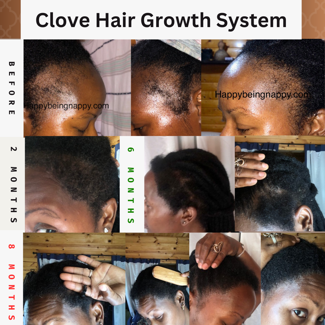 Clove Hair Growth Oil | Clove &Rosemary Black Soap Shampoo | Clove Water Hair Spray | Clove Deep Conditioner - SET